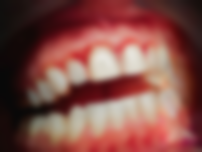 四、福州亚华口腔张勇跃医生坐诊医院