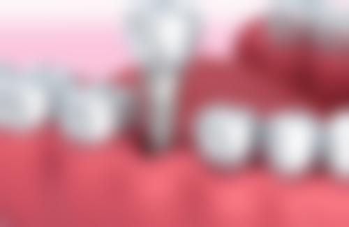 六、浙江嘉兴张宏英口腔口碑如何?