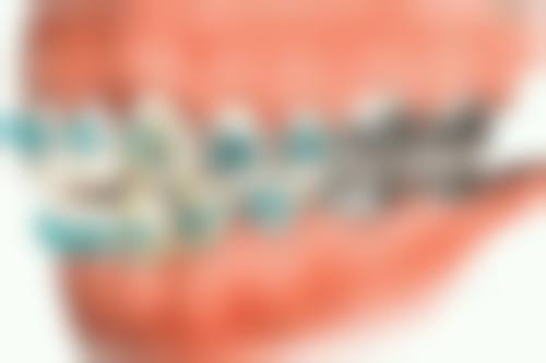 五、毕节威宁牙管家口腔门诊收费价格表