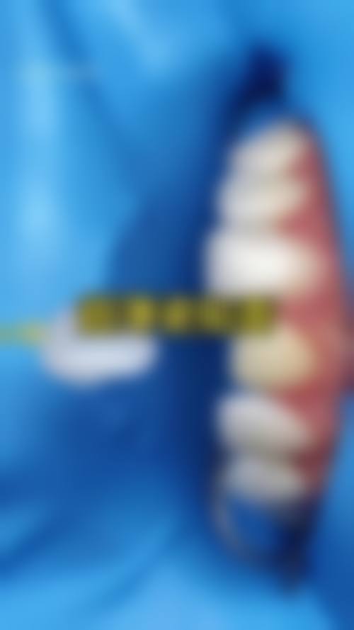 四、苏州美莱口腔特色项目