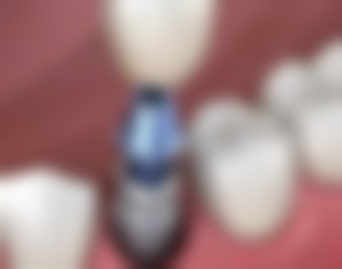 六、宜春丰城贝克口腔口碑如何？