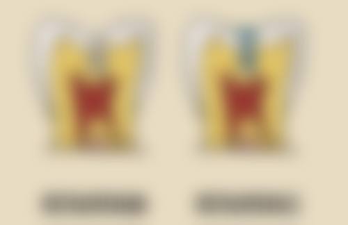 八、宜春丰城贝克口腔怎么预约？