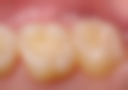 四、深圳大树口腔诊所特色项目