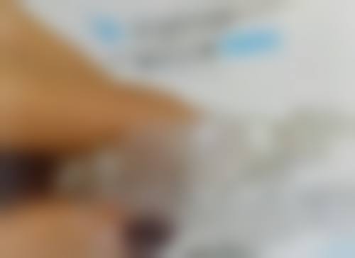 根管治疗都需要打桩吗?并非如此，牙体缺损程度等因素决定是否打桩，具体情况具体分析！ 