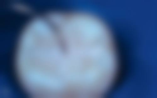 六、宜昌梁自明口腔诊所口碑如何？