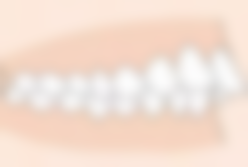 五、菏泽恒贝口腔彭凯医生技术怎么样？