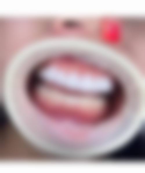 四、山东德州宁津爱齿口腔特色项目