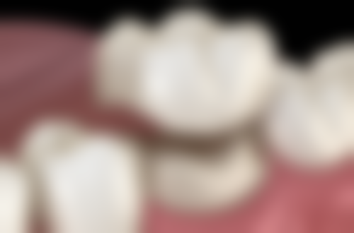 根管治疗对7岁孩子的好处