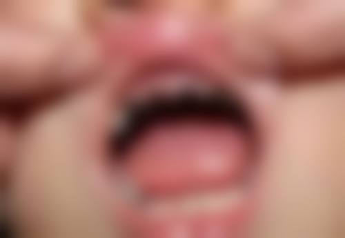 五、大连拜博口腔辛秀华医生技术怎么样？