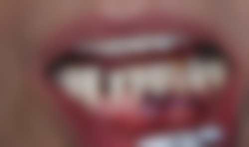 七、浙江金华义乌嘉和口腔地址电话及营业时间