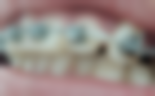 二、大连拜博口腔陈亚超医生擅长项目