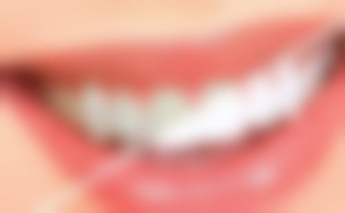 700元全瓷牙的质量和寿命