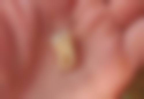 七、大连拜博口腔何玉斌医生怎么预约？