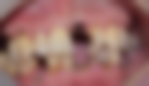 八、邯郸北极口腔医院怎么预约？