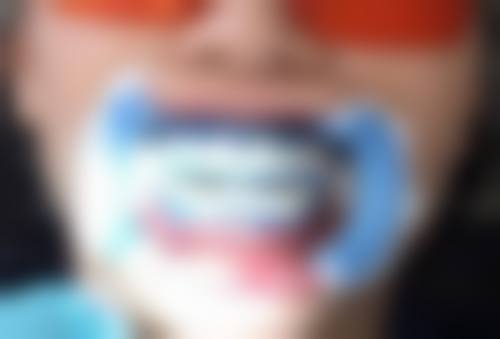 通用的拔牙公费医疗报销规则