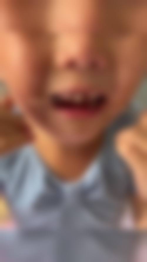 五、惠州致美口腔(恩笑门诊部)收费价格表