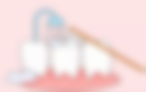 如何选择合适的全瓷牙