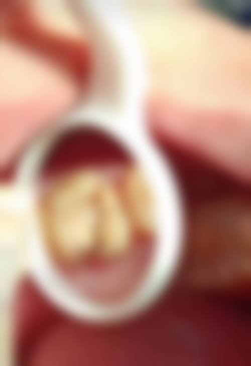 八、广东东莞虎门欧芽拜尔口腔门诊部怎么预约？