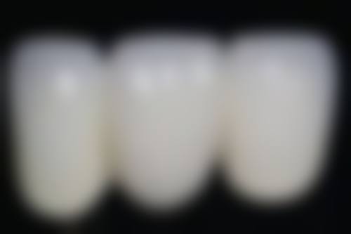 五、辽阳八一口腔苗乐医生技术怎么样？