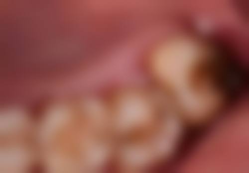 七、福州亚华口腔张勇跃医生怎么预约？