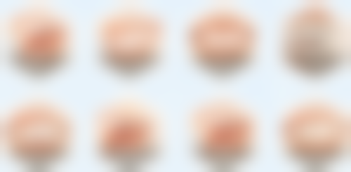 不同人群洗牙结石的合适频次