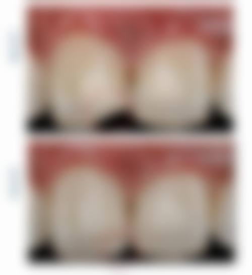 六、北京爵冠口腔(西三旗店)口碑如何？