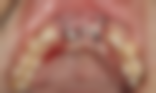 五、海南海口长德口腔收费价格表