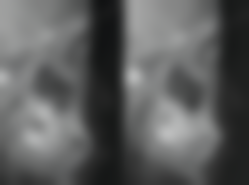 六、山西长治瑞波特史朝正医生口碑评价及真人实例反馈