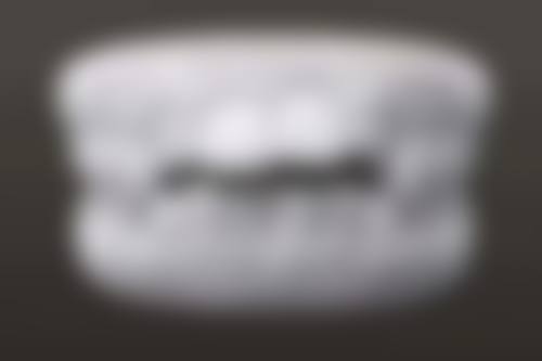 五、南京牙一生口腔门诊部收费价格表