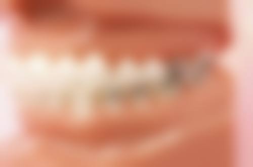 小孩虫牙需要做根管治疗吗？这得看龋坏程度、有无累及牙髓等，情况不同处理有别！ 