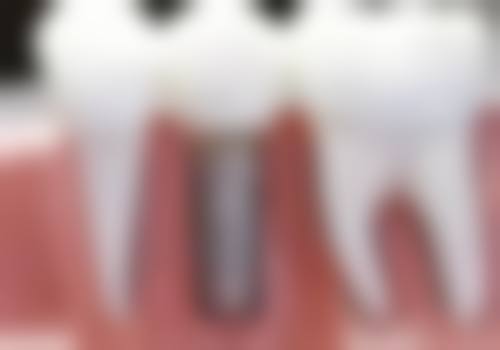 三、长沙市雨花区庭跃口腔医生介绍