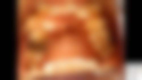 六、广东肇庆怀集郑林口腔口碑如何？