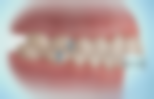 五、南京博韵口腔魏厚星医生技术怎么样？