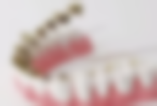 补牙时伤到牙神经多久可以好？恢复时间因损伤程度而异，短则数天，长则数月！ 