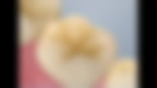 六、杭州任克辛口腔口碑如何？