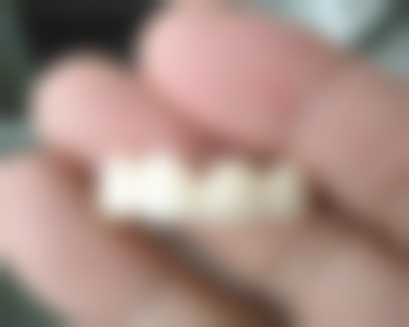 二、北京牙管家董枫莲医生擅长项目