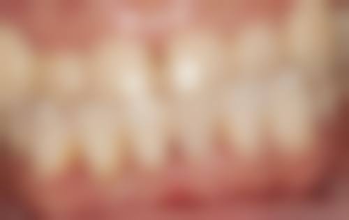 六、广州力德口腔口碑如何？