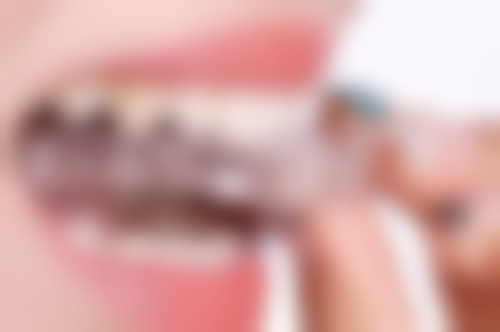 补完牙一周后可以洗牙吗？多数情况可行，但特殊情形如炎症、敏感等需暂缓，要听医生评估！ 