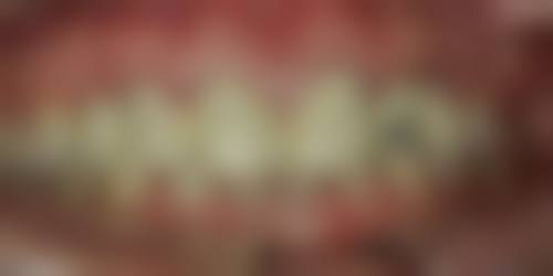 八、广东肇庆弘远口腔怎么预约？