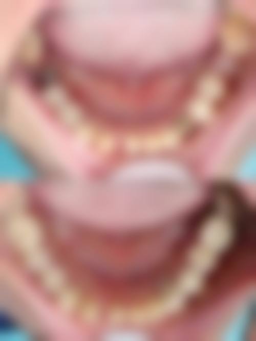 六、广州菲亚口腔矫正·种植联合中 心(总店)口碑如何？