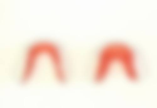 牙疼时可以补牙洞吗？这取决于牙痛诱因，不同情况处理方式不同，盲目补牙不可取！ 