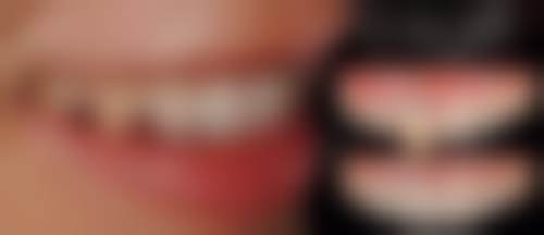六、东莞恒好口腔口碑如何？
