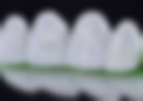 六、佛山协大口腔诊所口碑如何？