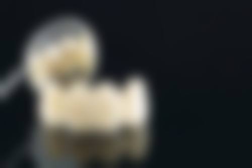 拔牙为什么要切开牙龈？原来是为减少阻力、暴露术区，还能避免断根残留降低损伤风险！ 
