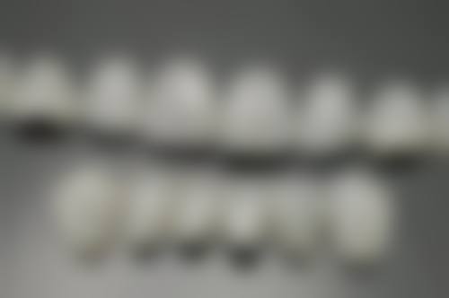 取下烤瓷牙后的护理