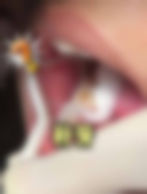五、宝鸡市高新开发区拜伦口腔诊所收费价格表