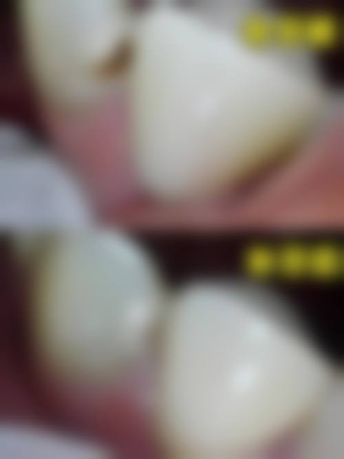 八、浙江嘉兴唯美口腔门诊部怎么预约?