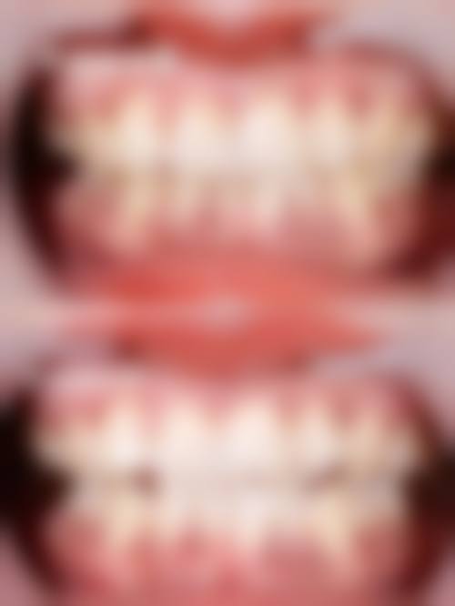 八、滁州博雅口腔怎么预约?