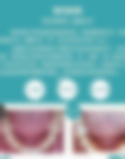 四、南昌牙美兔斯美口腔特色项目
