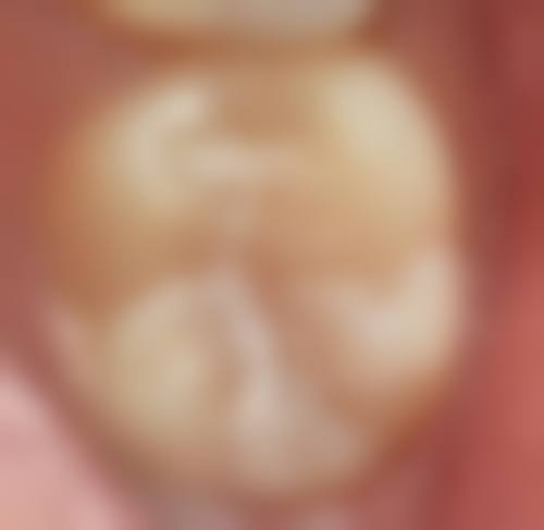 八、潍坊经济明珠口腔怎么预约?